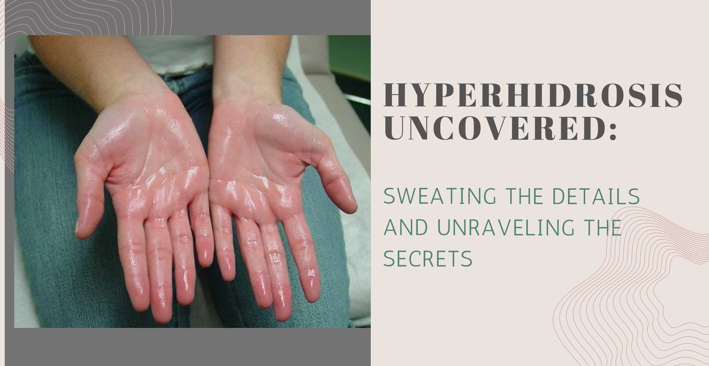 Hyperhidrosis Uncovered Sweating the Details and Unraveling the ...