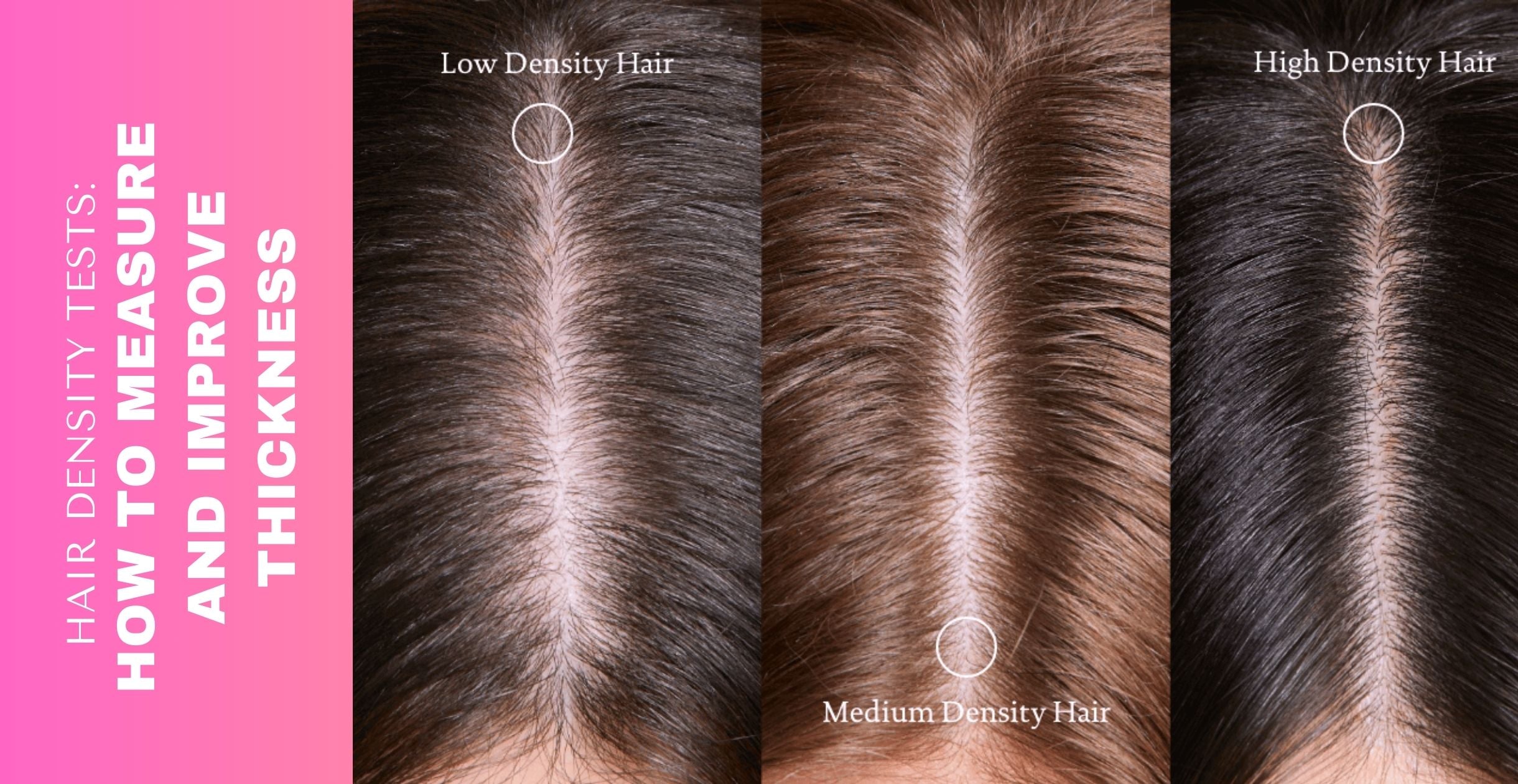 Hair Density Tests How to Measure and Improve Thickness   Clinikally