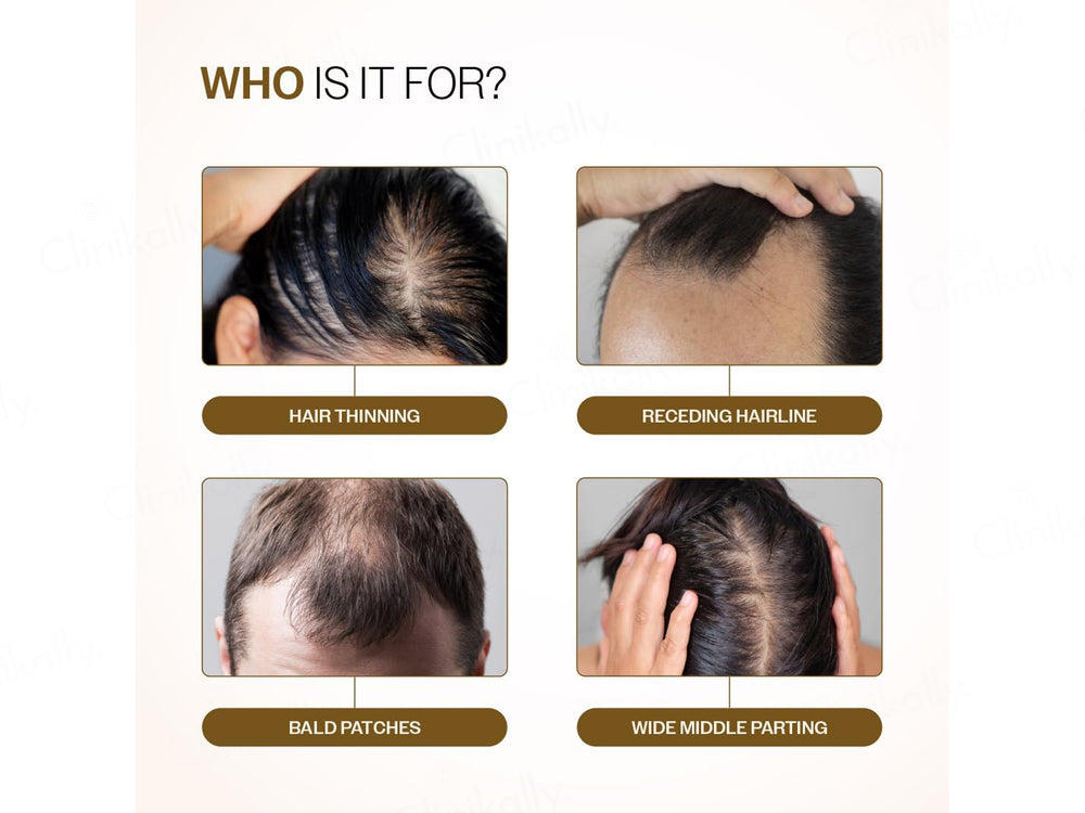 Bare Anatomy Advanced Hair Growth Serum Roll-On