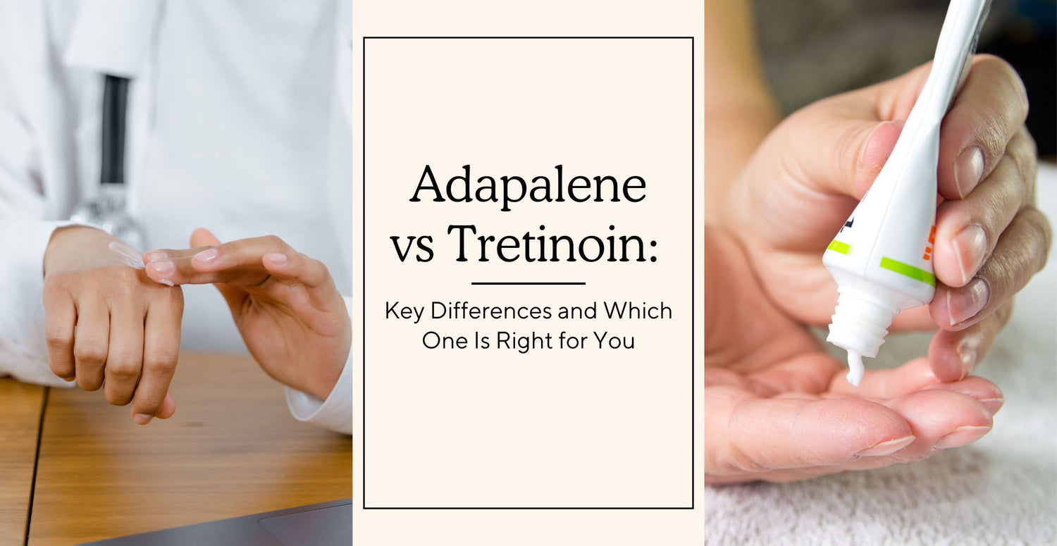 Adapalene vs Tretinoin: Key Differences and Which One Is Right for You