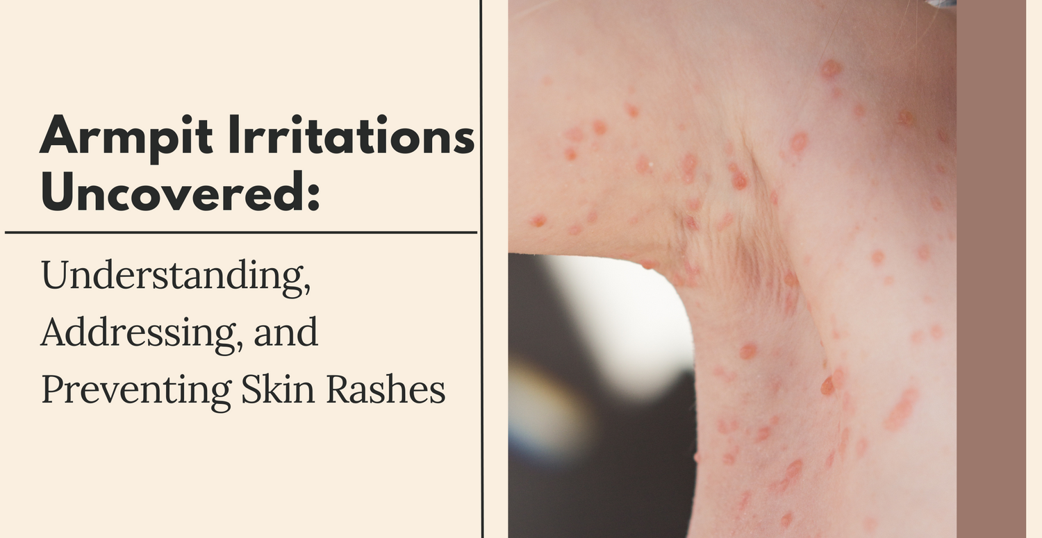 Armpit Irritations Uncovered: Understanding, Addressing, and Preventing Skin Rashes