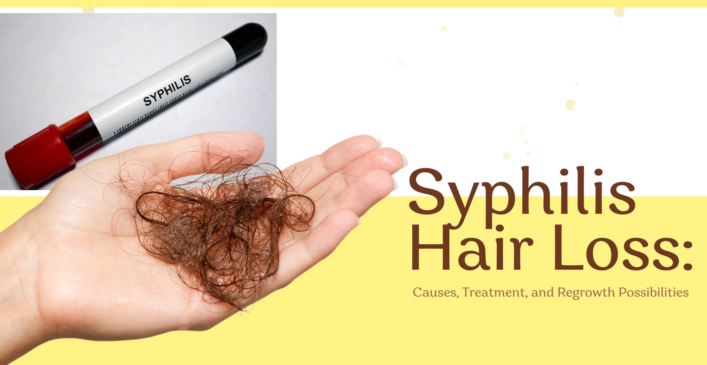 Syphilis Hair Loss: Causes, Treatment, and Regrowth Possibilities