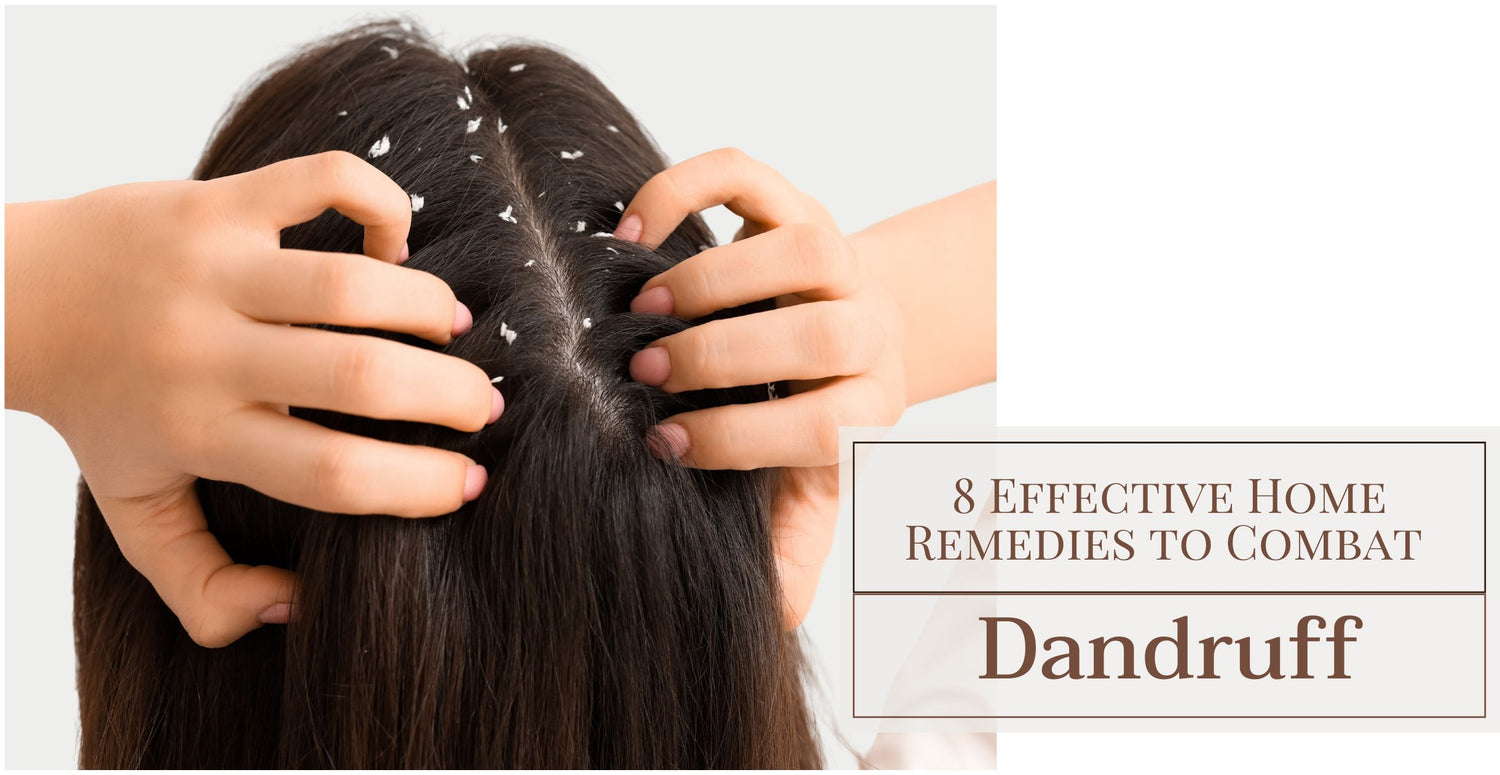 8 Effective Home Remedies to Combat Dandruff