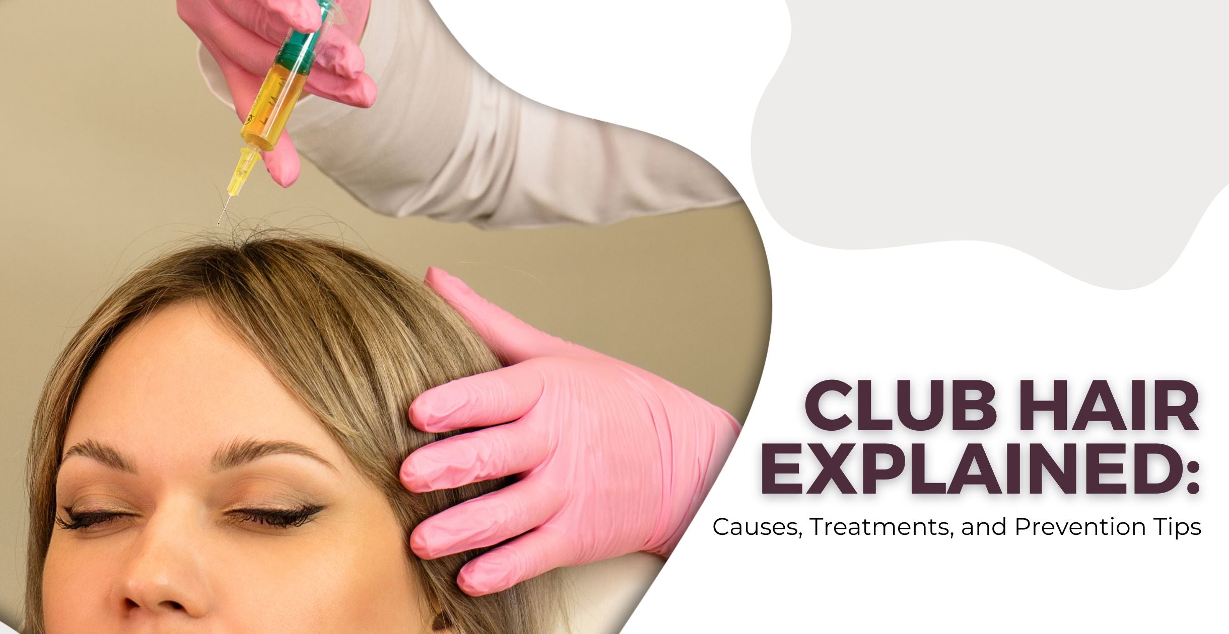 Club Hair Explained: Causes, Treatments, and Prevention Tips