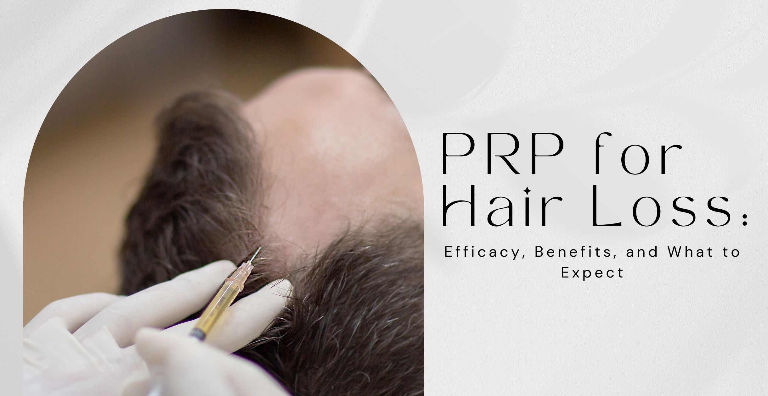 PRP for Hair Loss: Efficacy, Benefits, and What to Expect