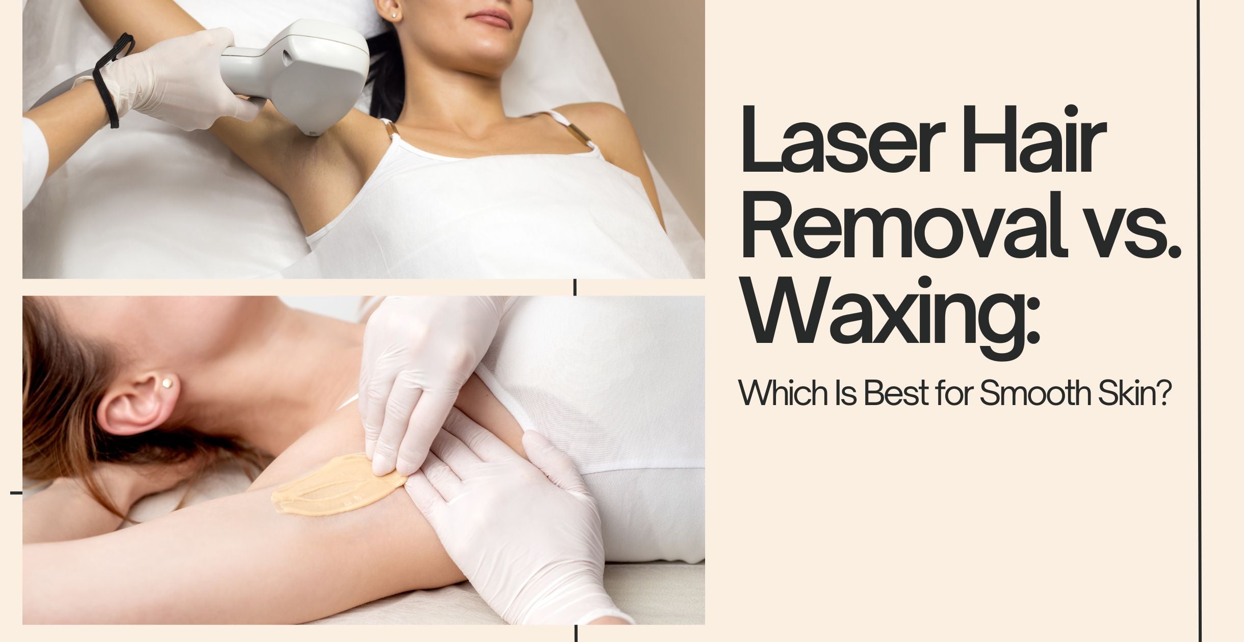 Laser Hair Removal vs. Waxing: Which Is Best for Smooth Skin?