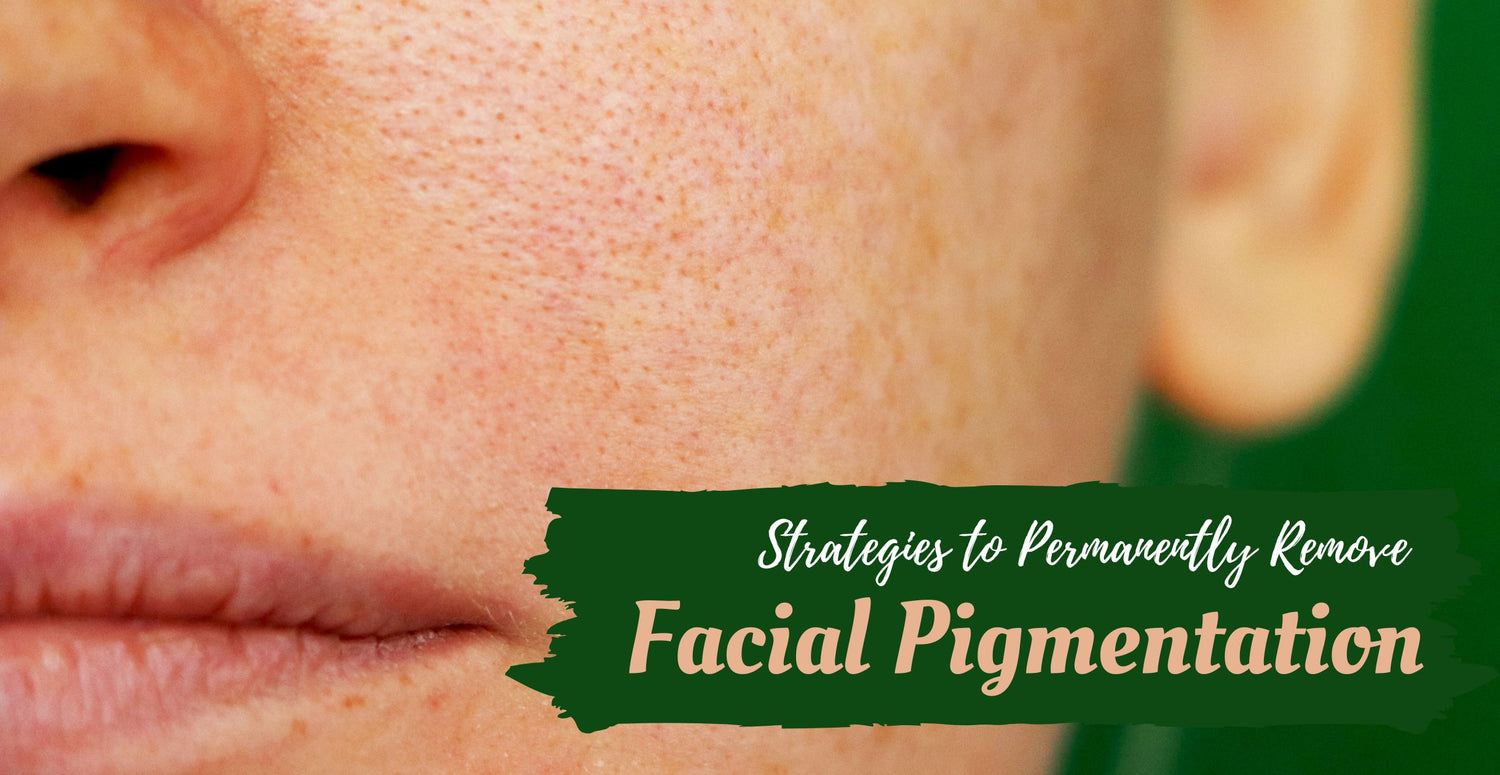 Strategies to Permanently Remove Facial Pigmentation