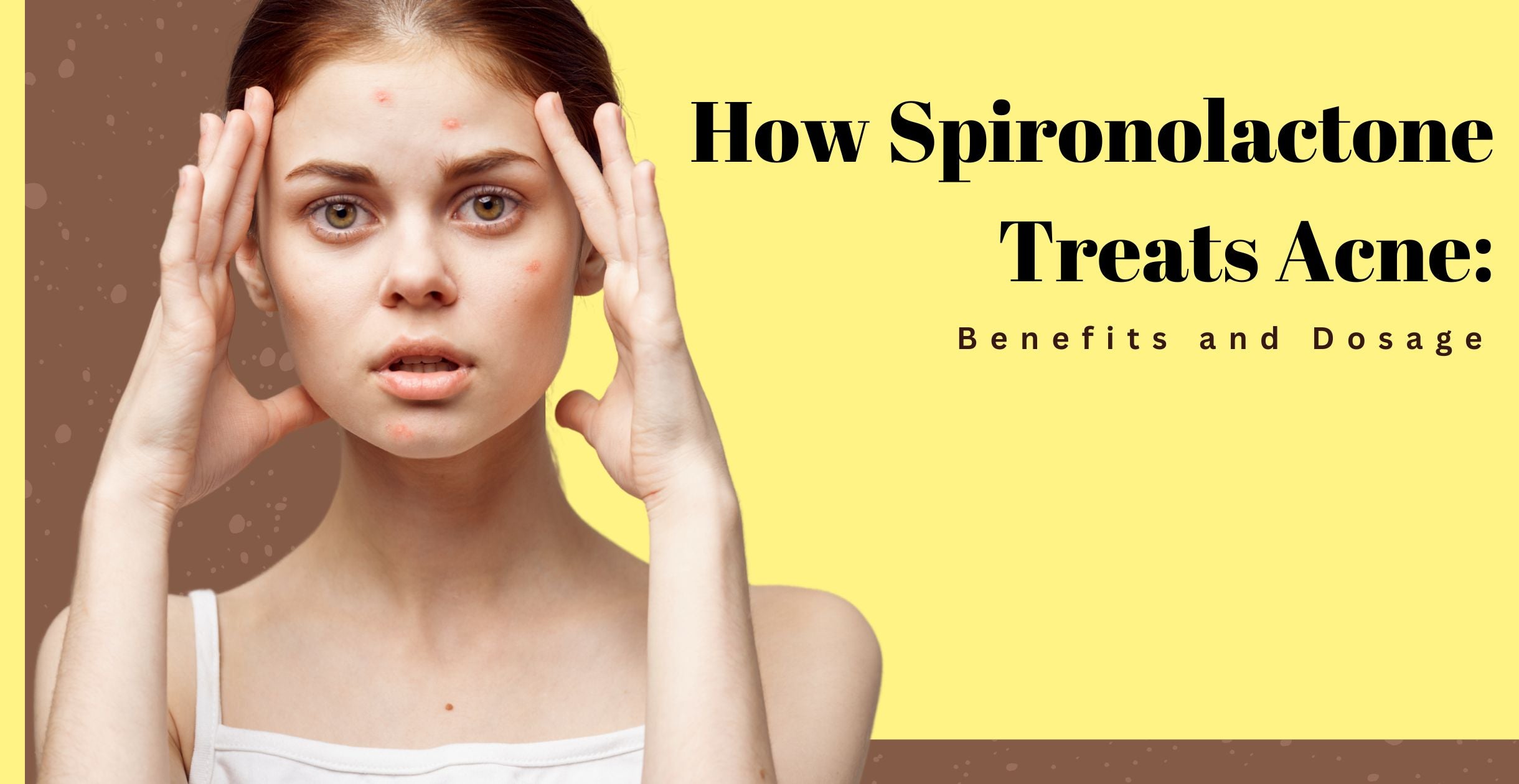 How Spironolactone Treats Acne: Benefits and Dosage