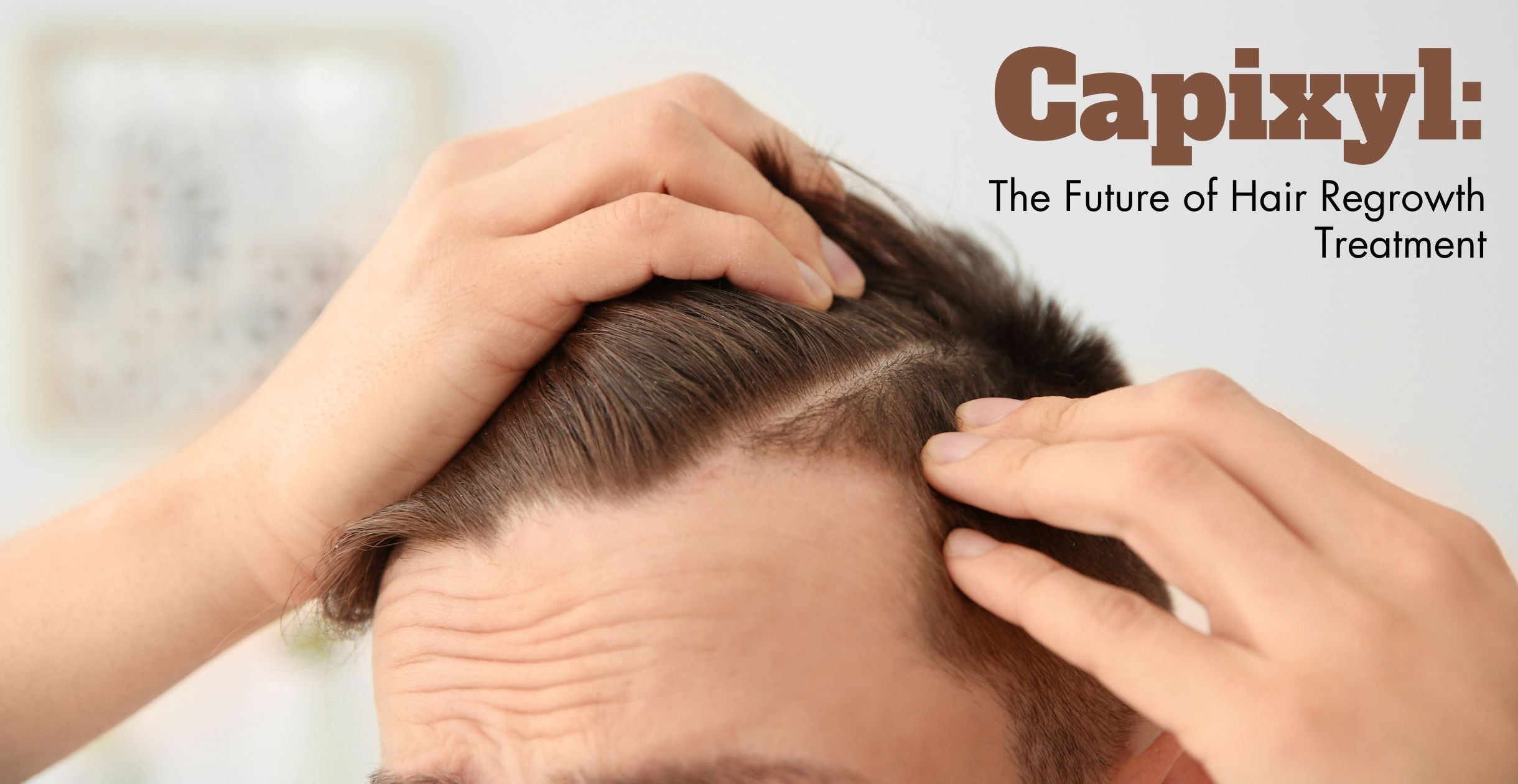 Capixyl: The Future of Hair Regrowth Treatment