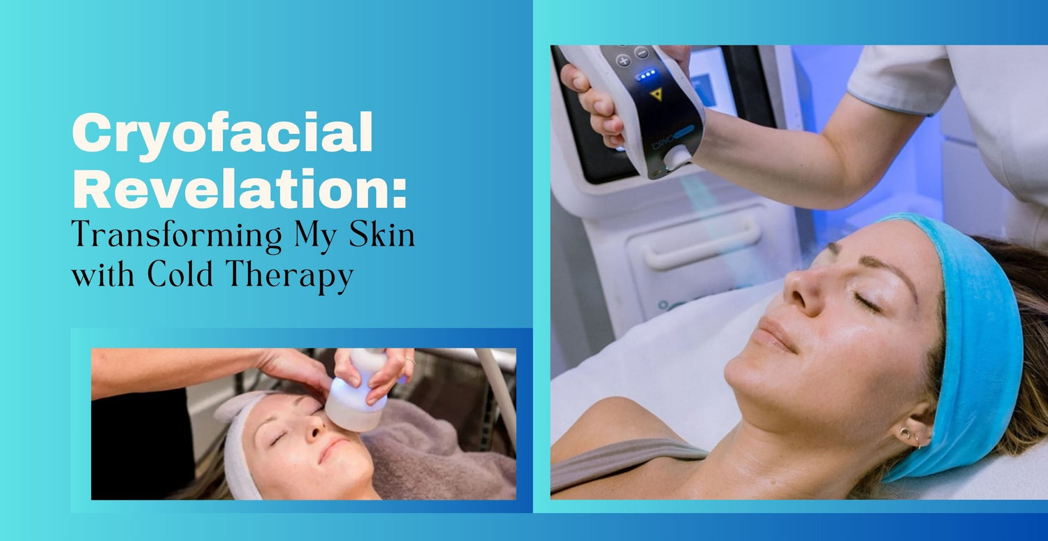 Cryofacial Revelation: Transforming My Skin with Cold Therapy