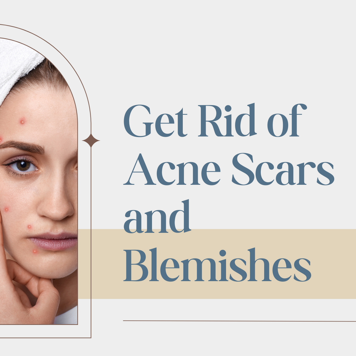 Easy Way to Get Rid of Acne Scars Blemishes Clinikally