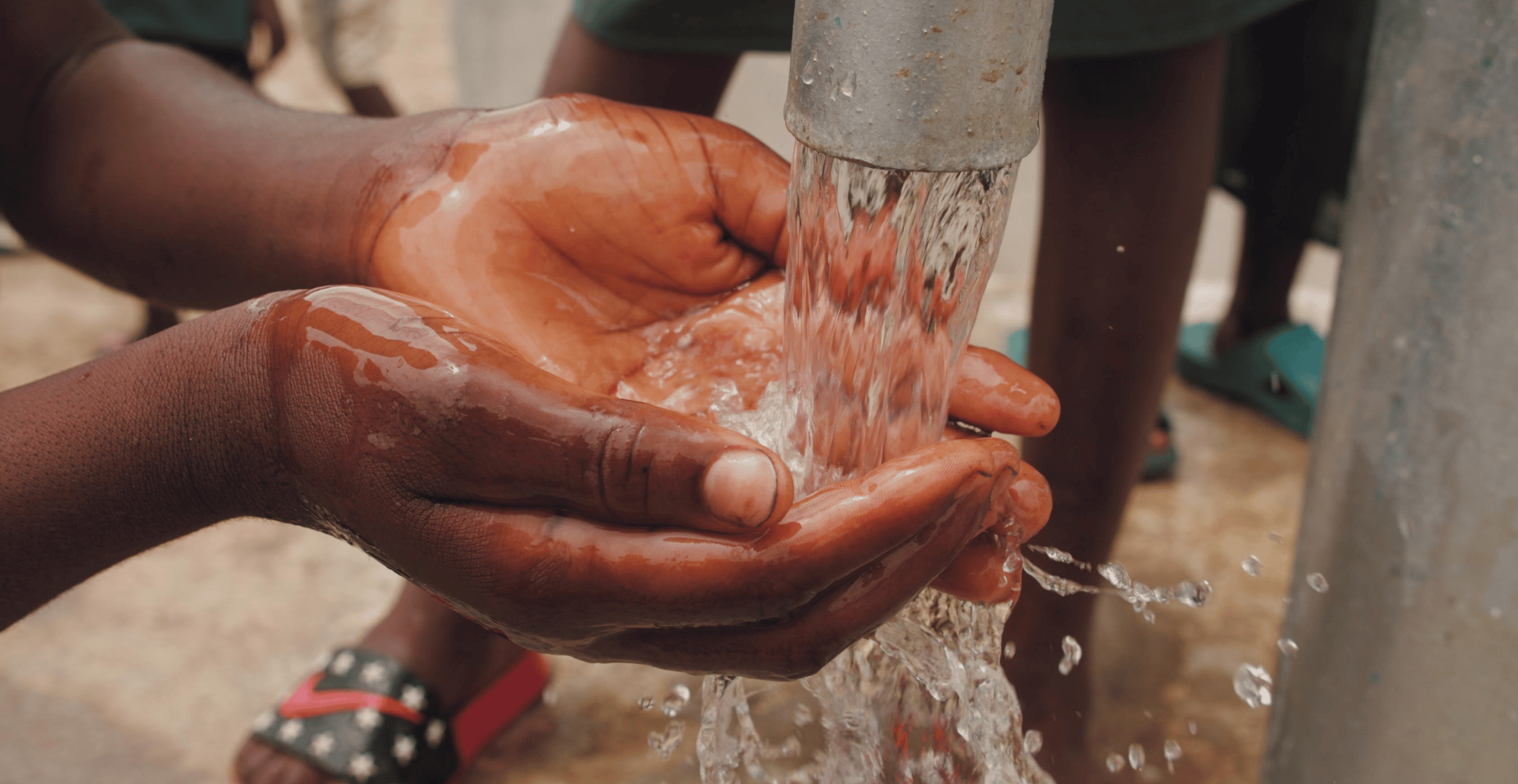 Effect of water quality on skin tone