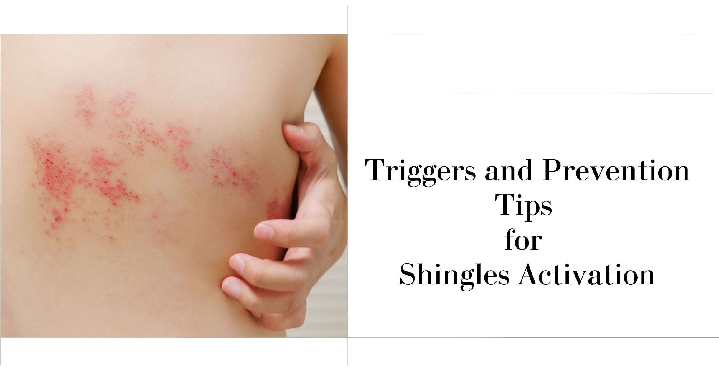 Triggers and Prevention Tips for Shingles Activation