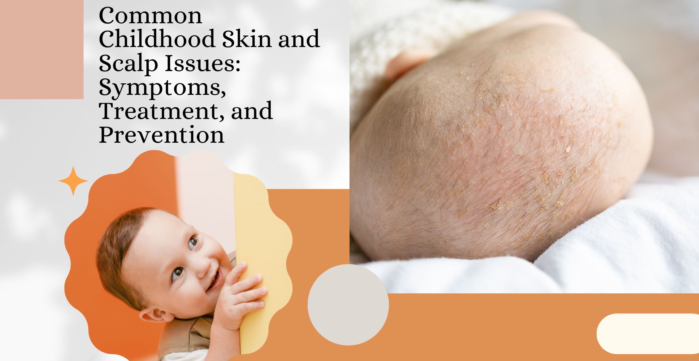 H1: Common Childhood Skin and Scalp Issues: Symptoms, Treatment, and Prevention