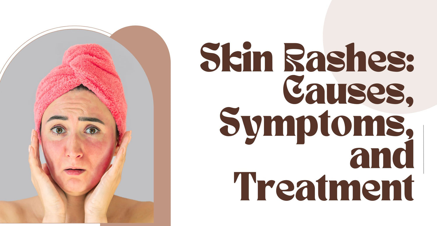 How Telemedicine Can Diagnose 16 Common Skin Rashes - Care on Location