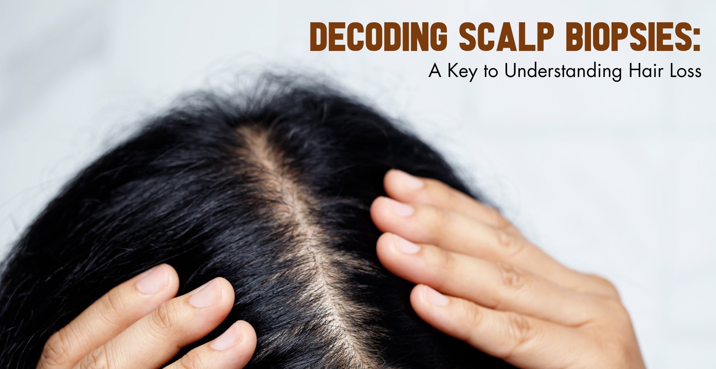 Decoding Scalp Biopsies: A Key to Understanding Hair Loss
