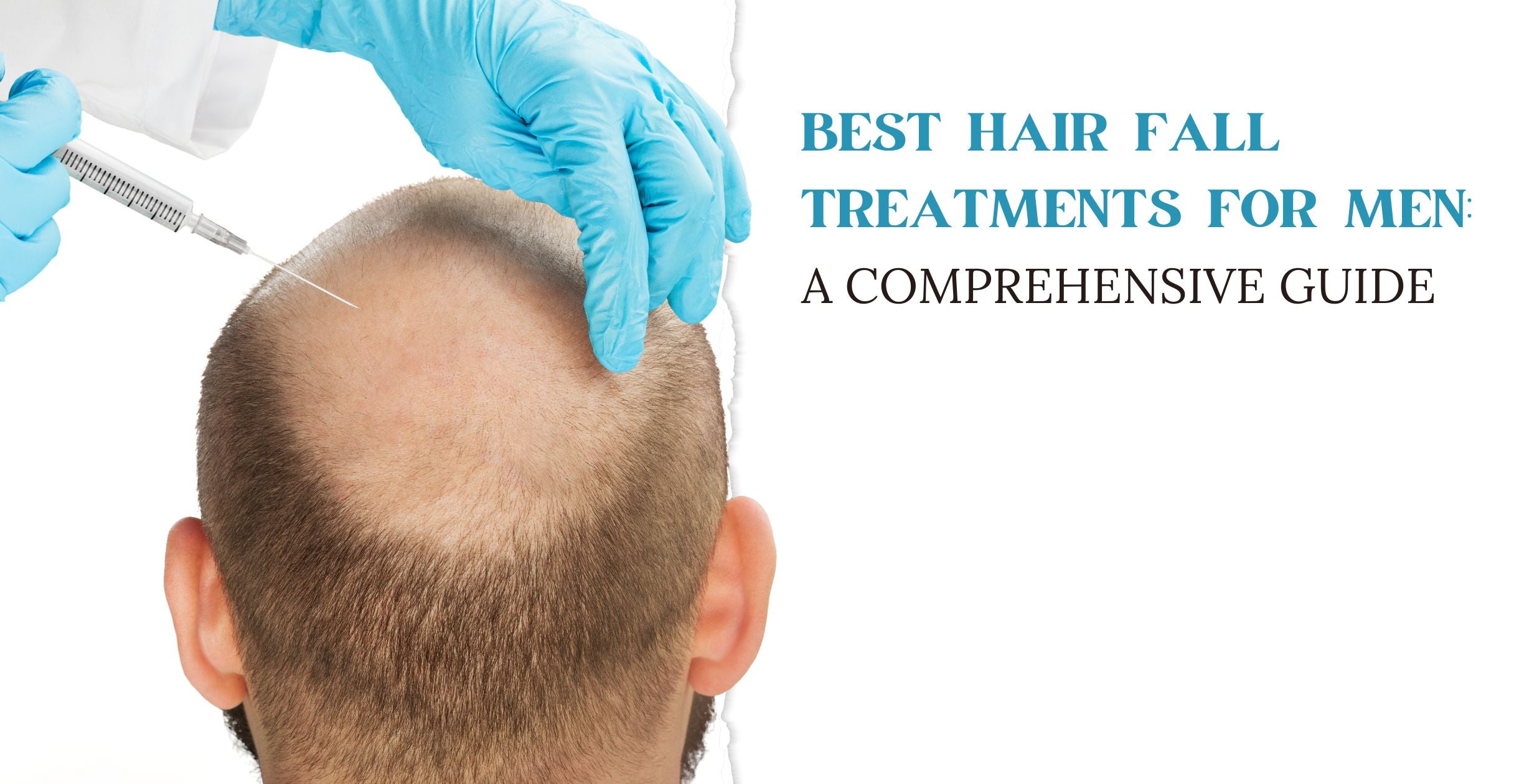 Best Hair Fall Treatments for Men: A Comprehensive Guide