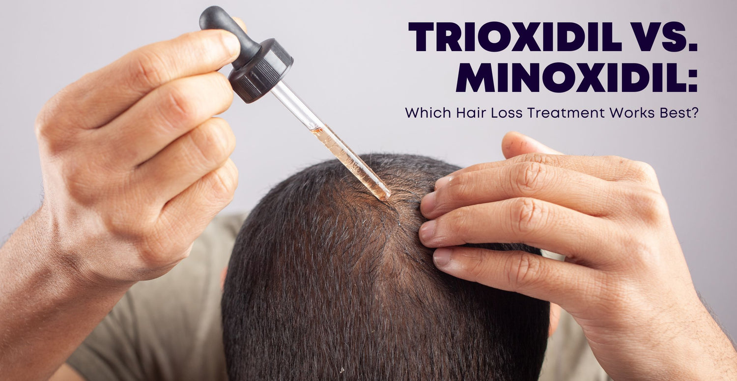 Trioxidil vs. Minoxidil: Which Hair Loss Treatment Works Best?