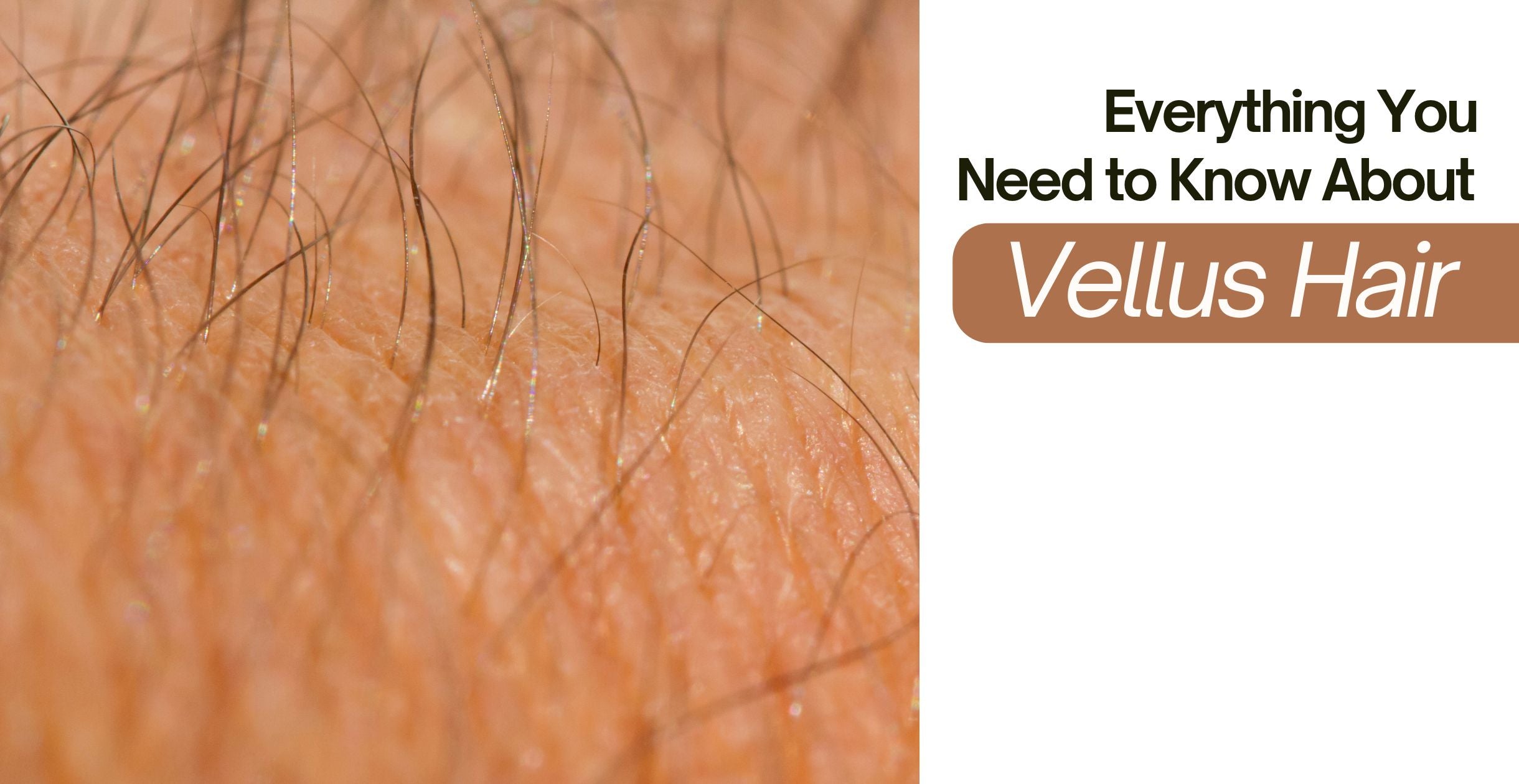 Everything You Need to Know About Vellus Hair