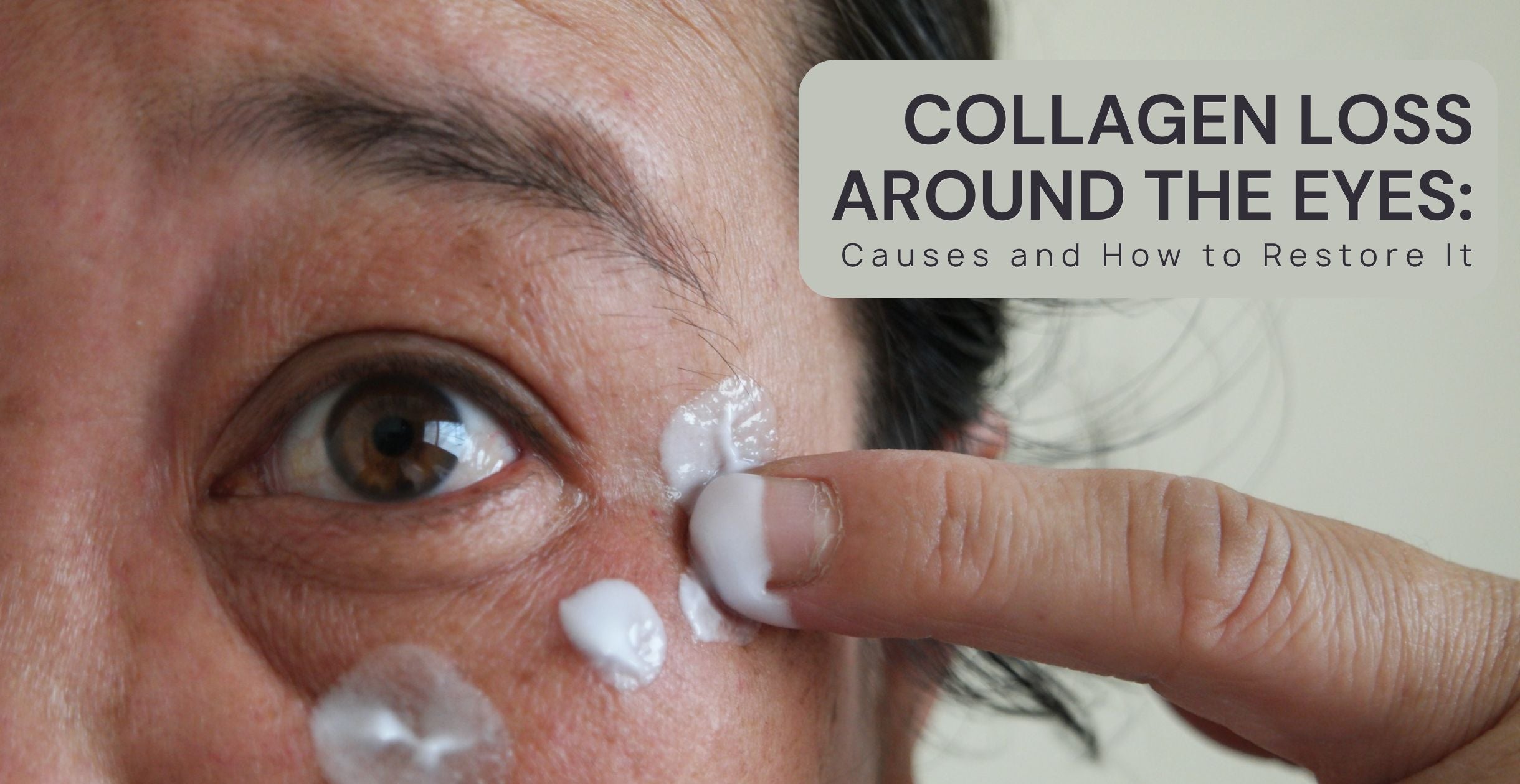 Collagen Loss Around the Eyes: Causes and How to Restore It