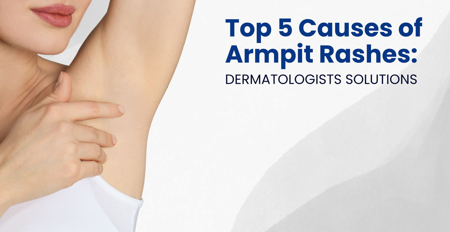 Top 5 Causes of Armpit Rashes: Dermatologists Solutions