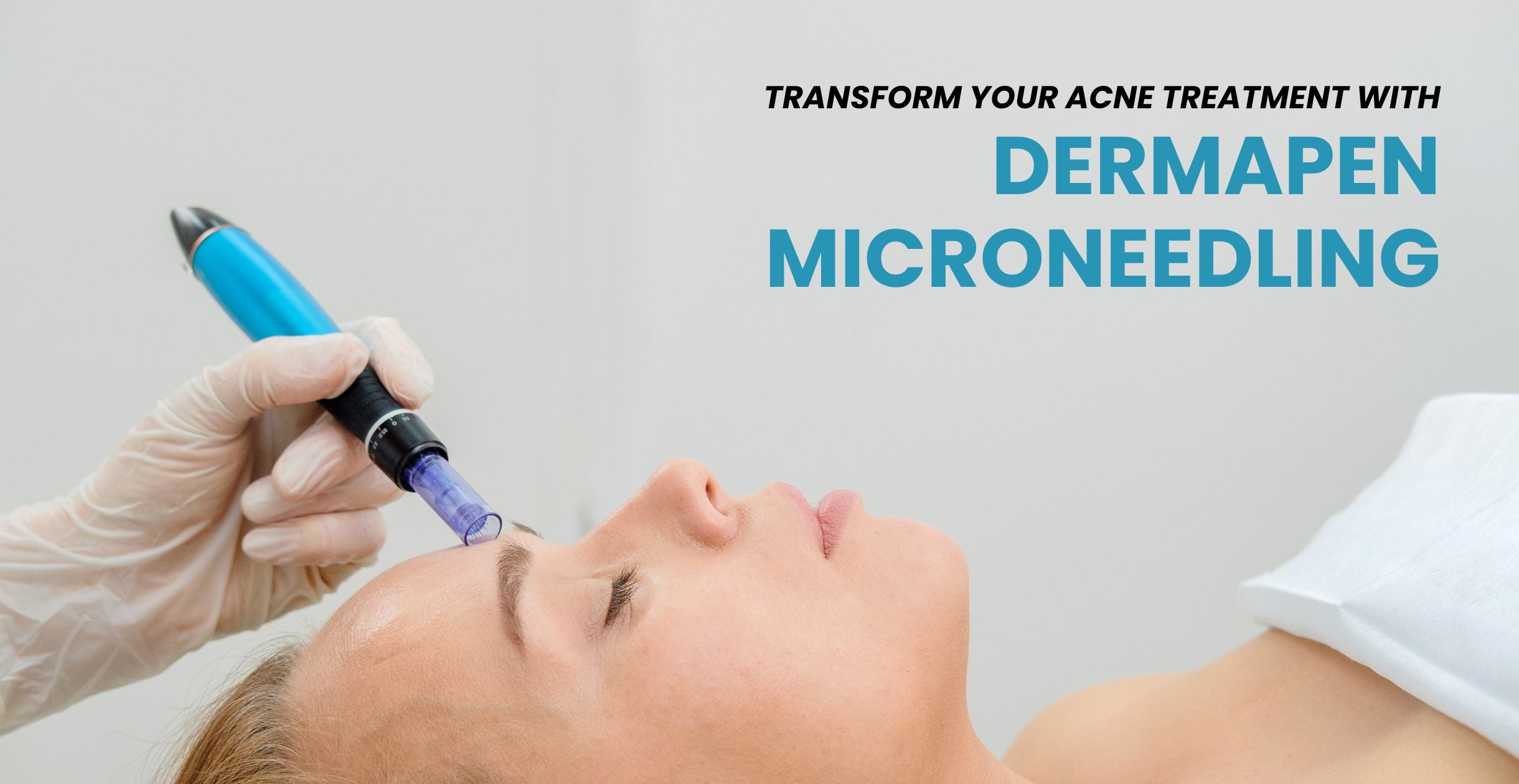 Transform Your Acne Treatment with Dermapen Microneedling