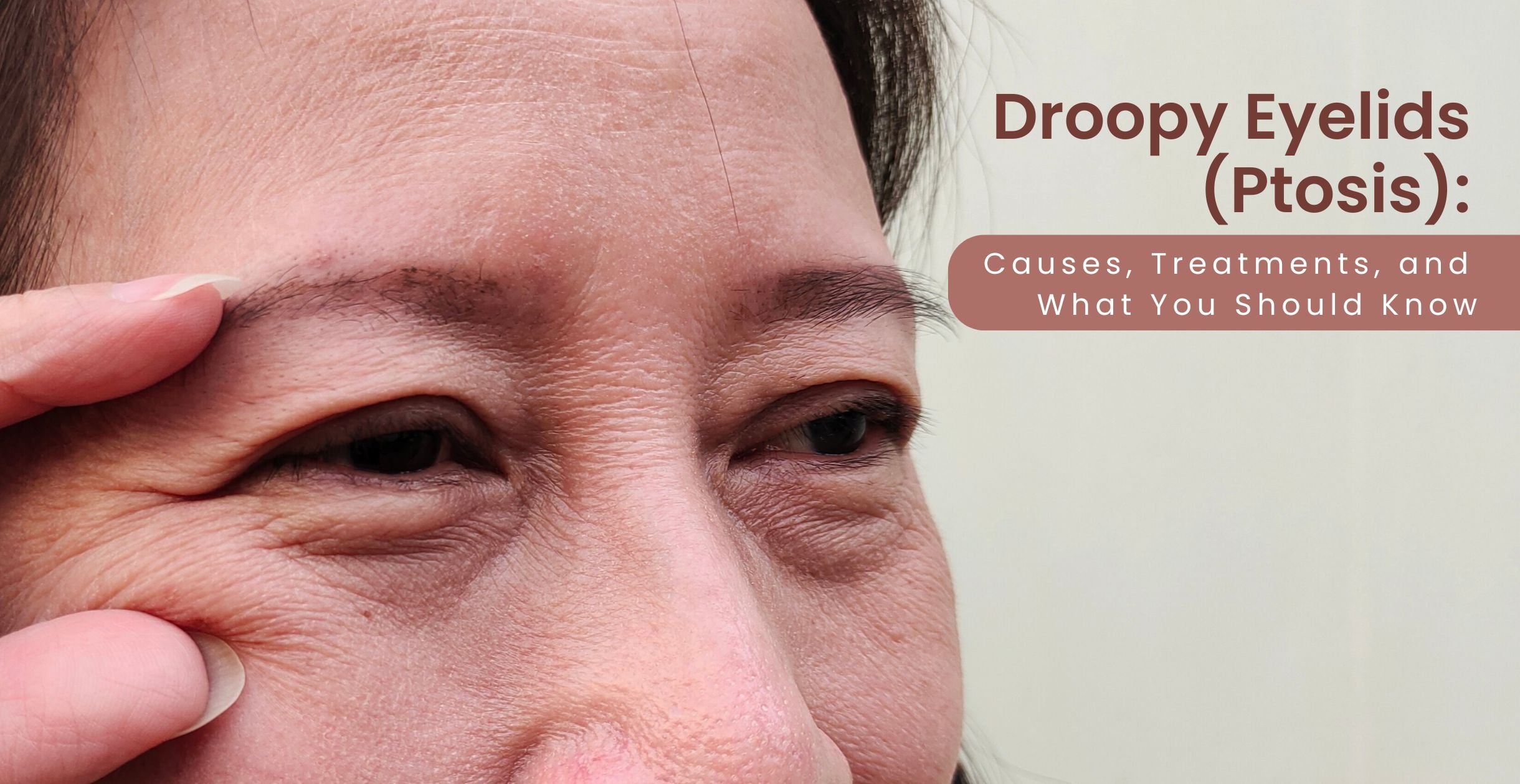 Droopy Eyelids (Ptosis): Causes, Treatments, and What You Should Know