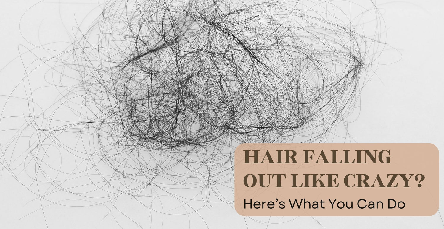 Hair Falling Out Like Crazy? Here’s What You Can Do