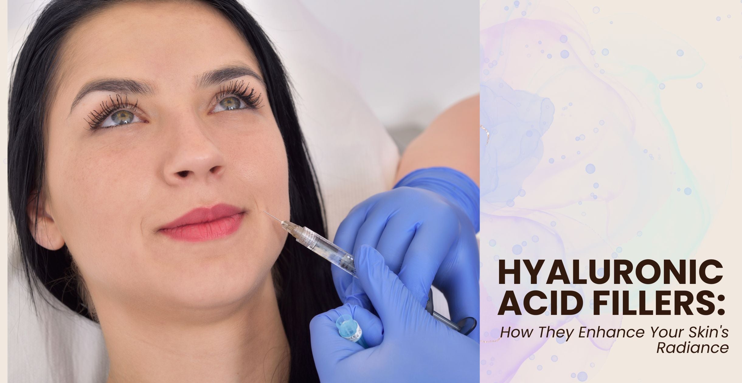 Hyaluronic Acid Fillers: How They Enhance Your Skin's Radiance