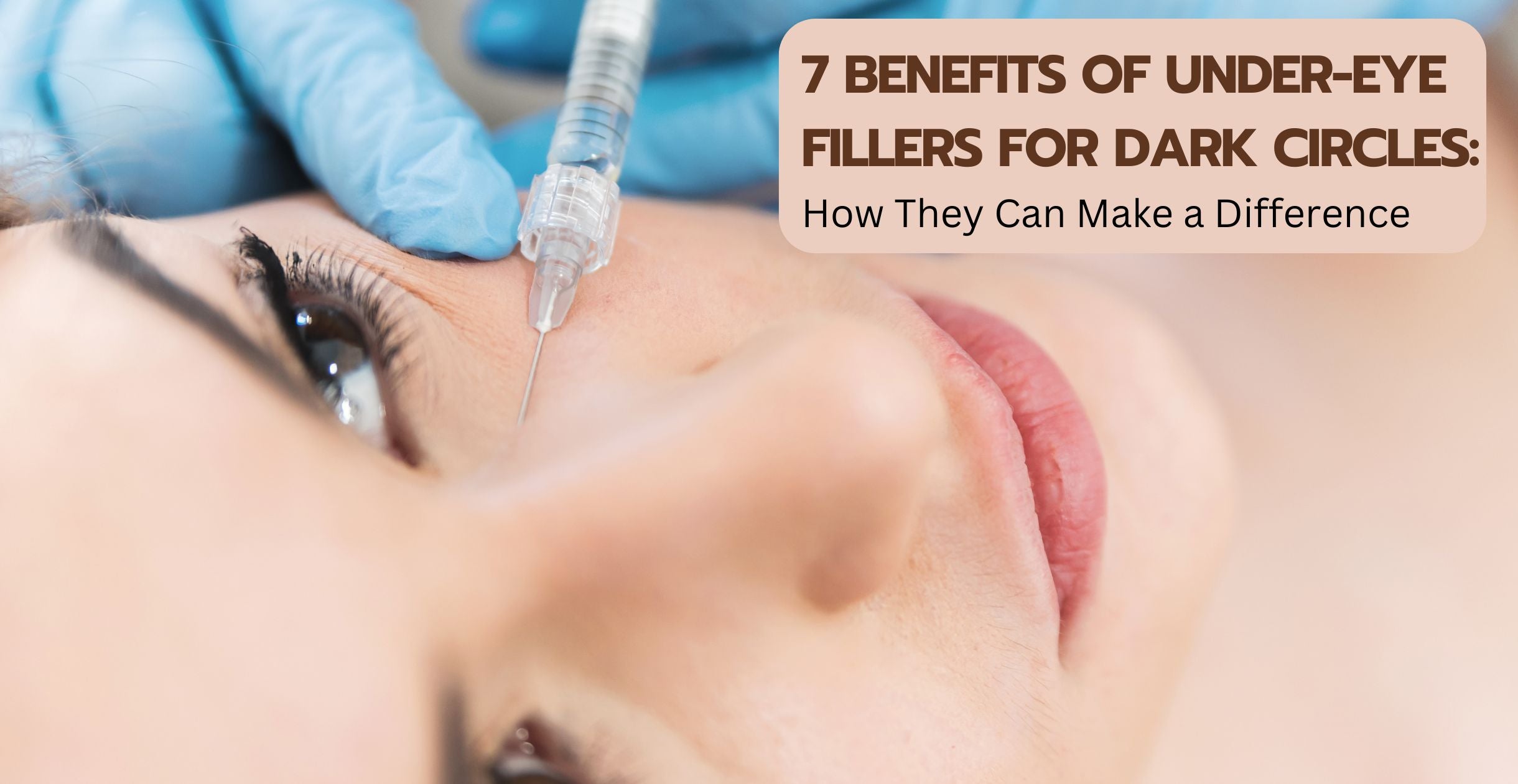 7 Benefits of Under-Eye Fillers for Dark Circles: How They Can Make a Difference