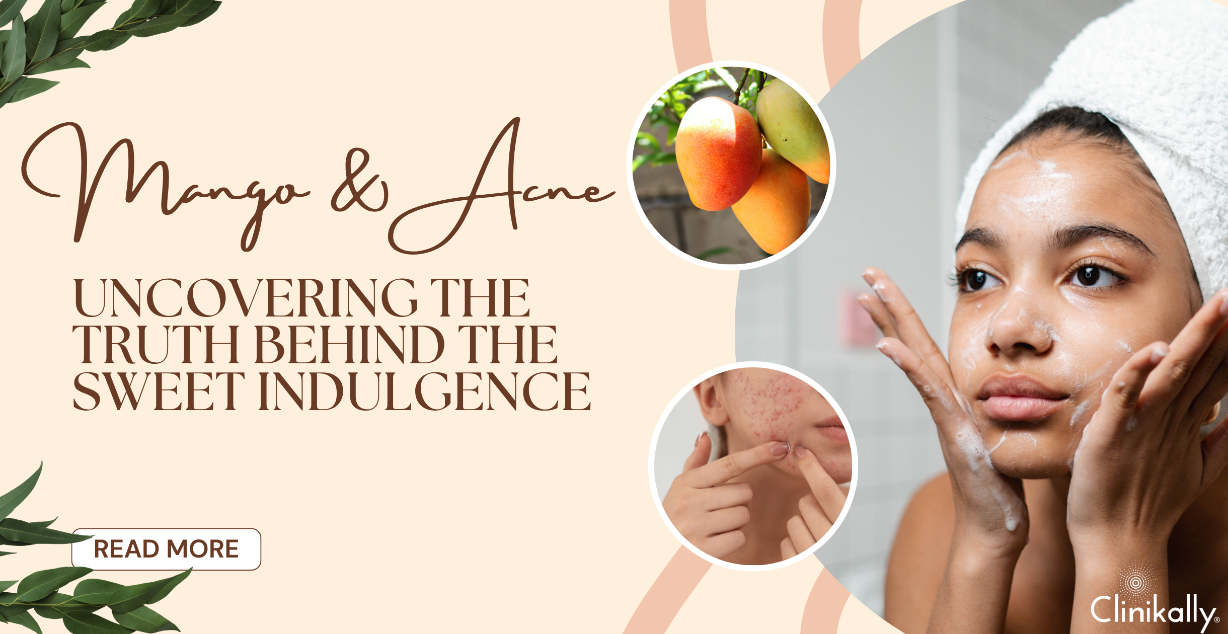 Mango and Acne: Uncovering the Truth Behind the Sweet Indulgence