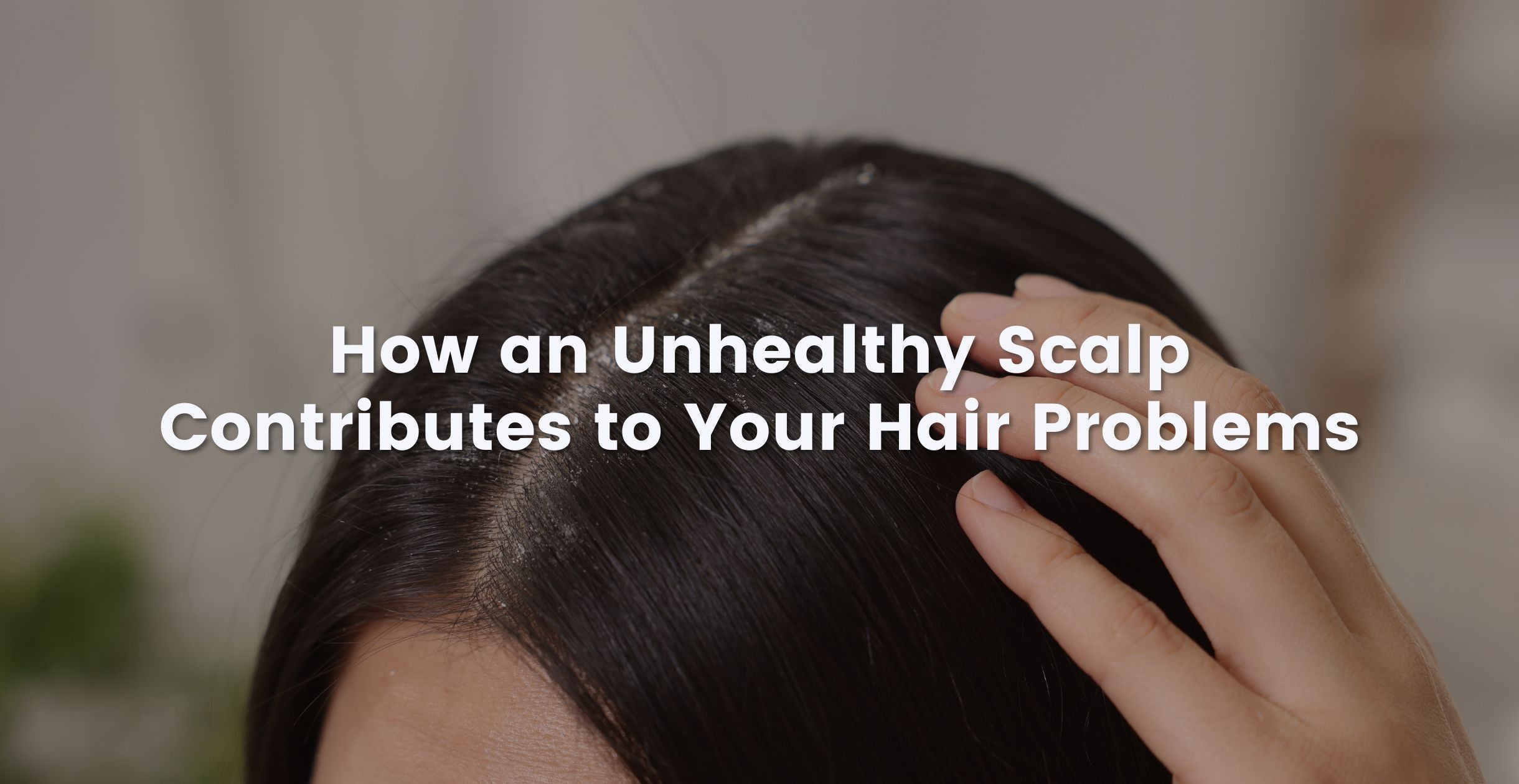 How an Unhealthy Scalp Contributes to Your Hair Problems