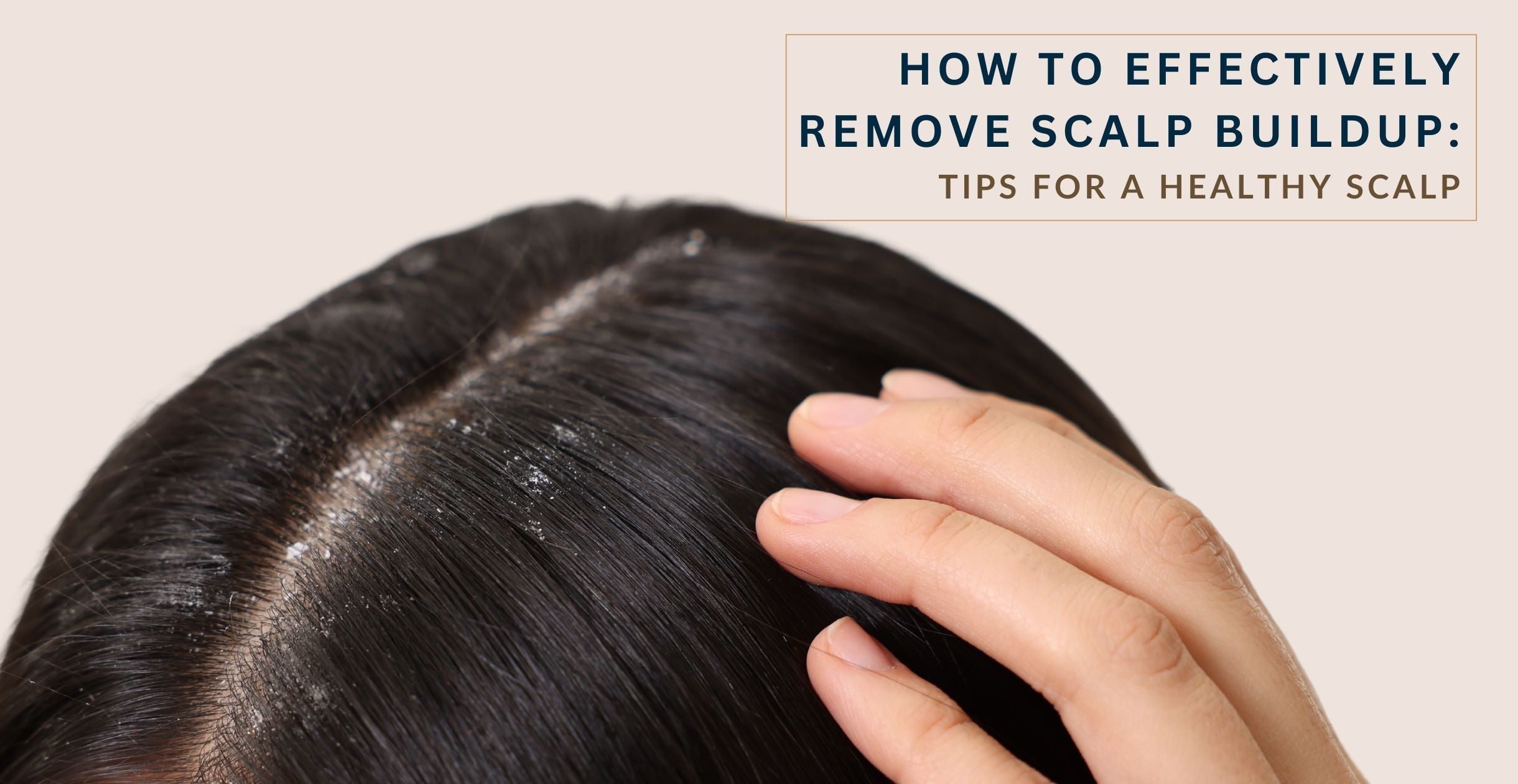  How to Effectively Remove Scalp Buildup: Tips for a Healthy Scalp