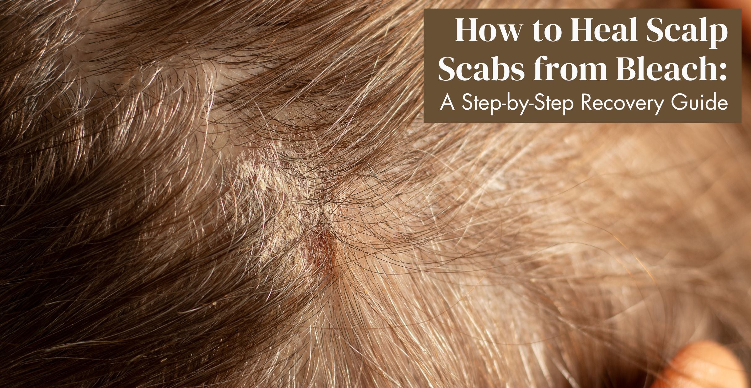  How to Heal Scalp Scabs from Bleach: A Step-by-Step Recovery Guide