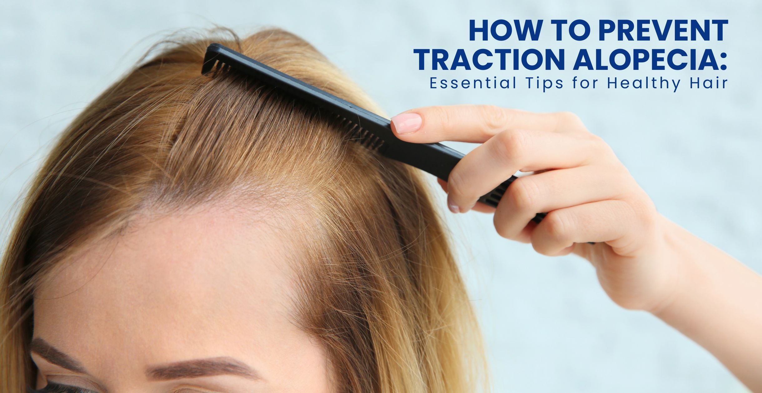 How to Prevent Traction Alopecia: Essential Tips for Healthy Hair