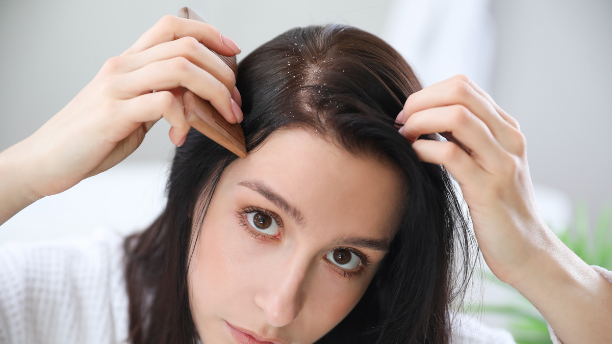 Why Hair Color Can Cause an Itchy Scalp