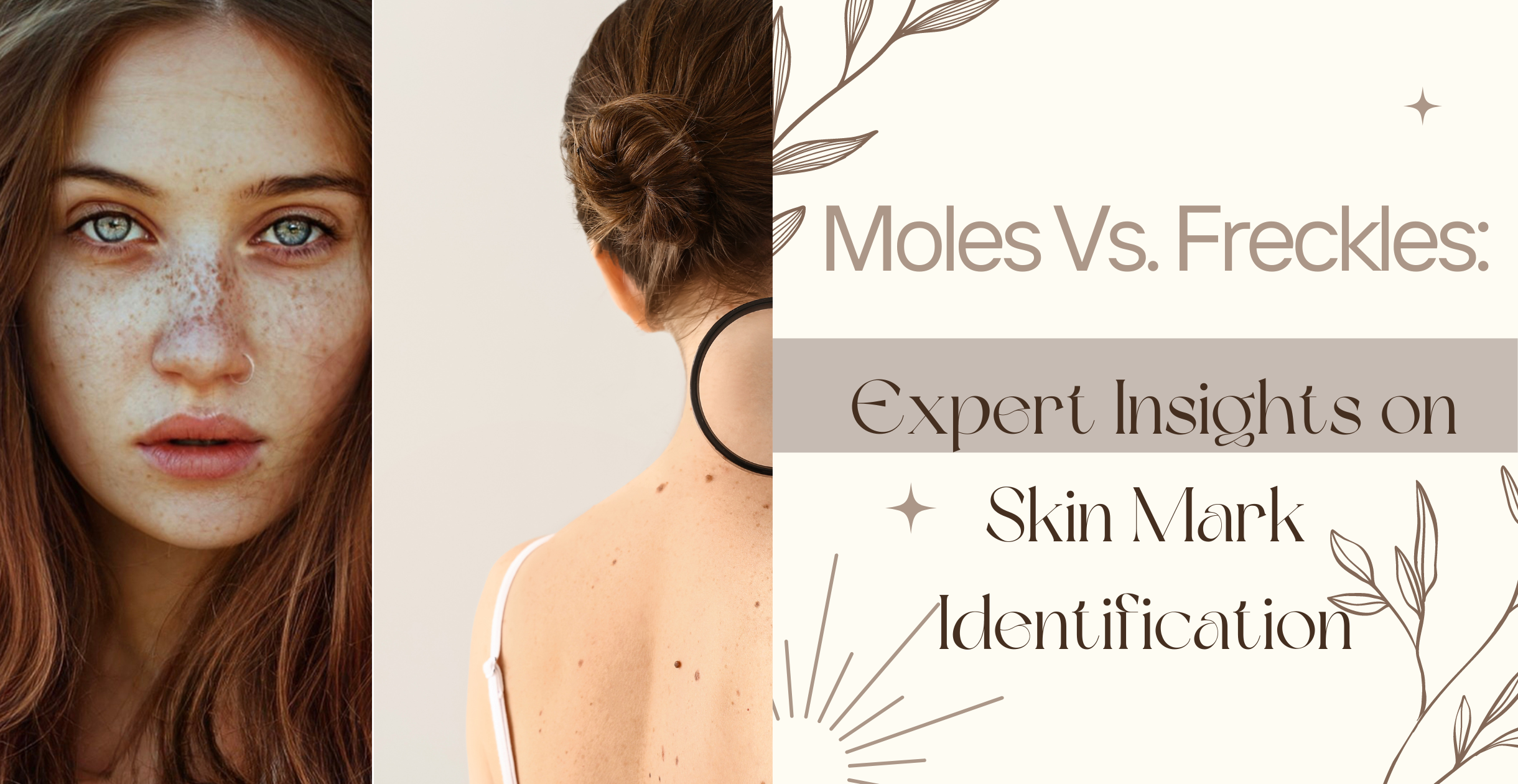 Why Mole Removal is Important | Mole Removal Cost - Desmoderm