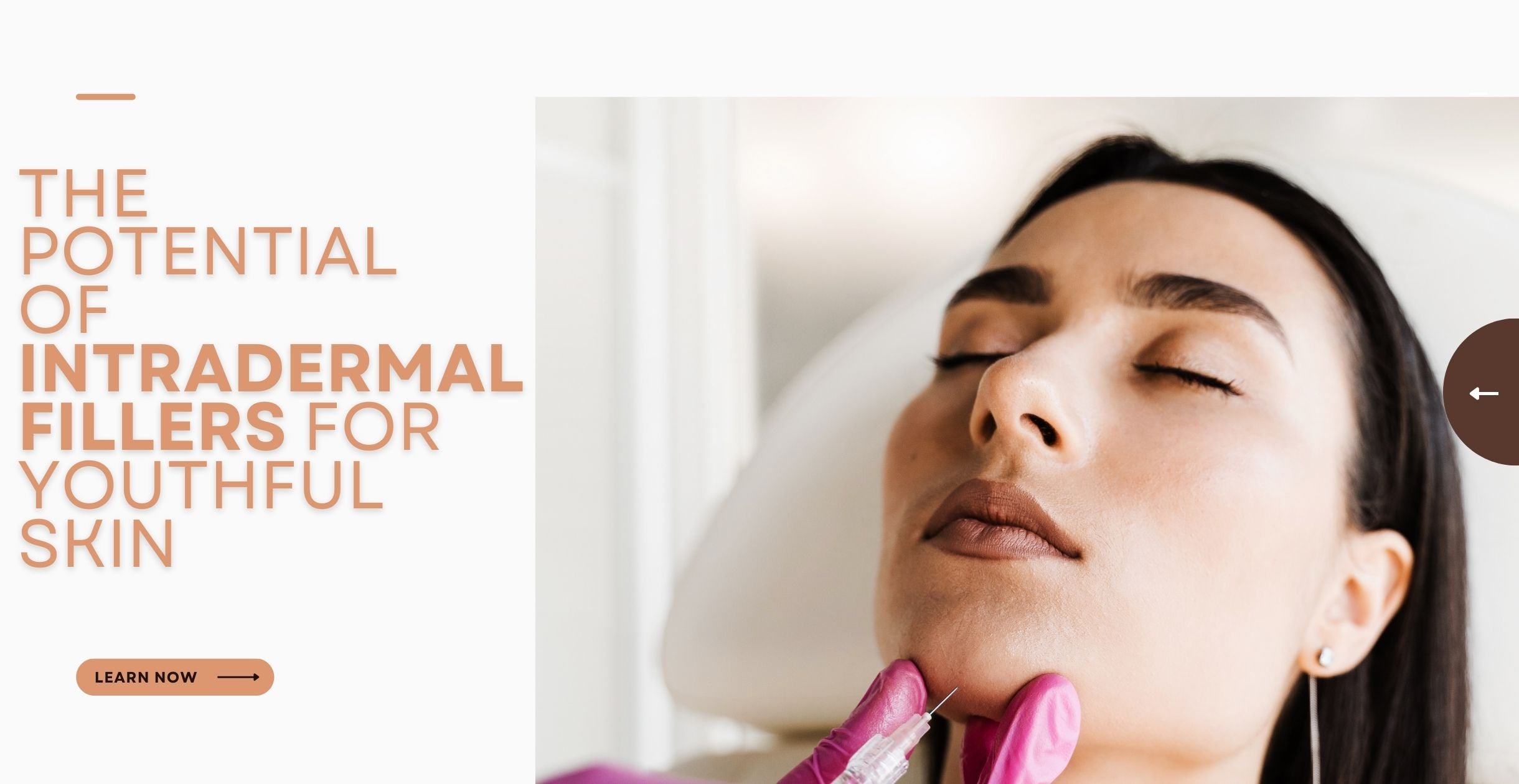 The Potential of Intradermal Fillers for Youthful Skin