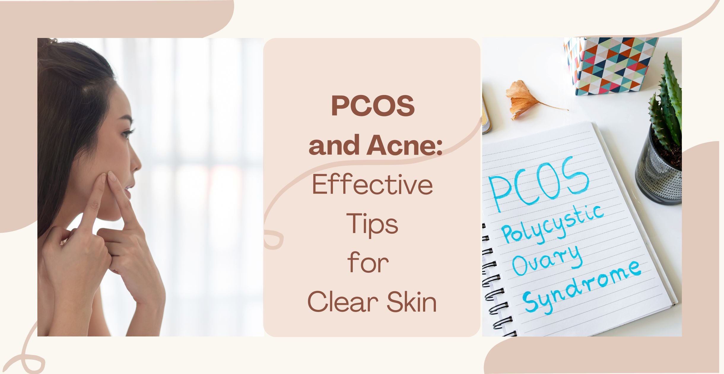 PCOS and Acne: Effective Tips for Clear Skin