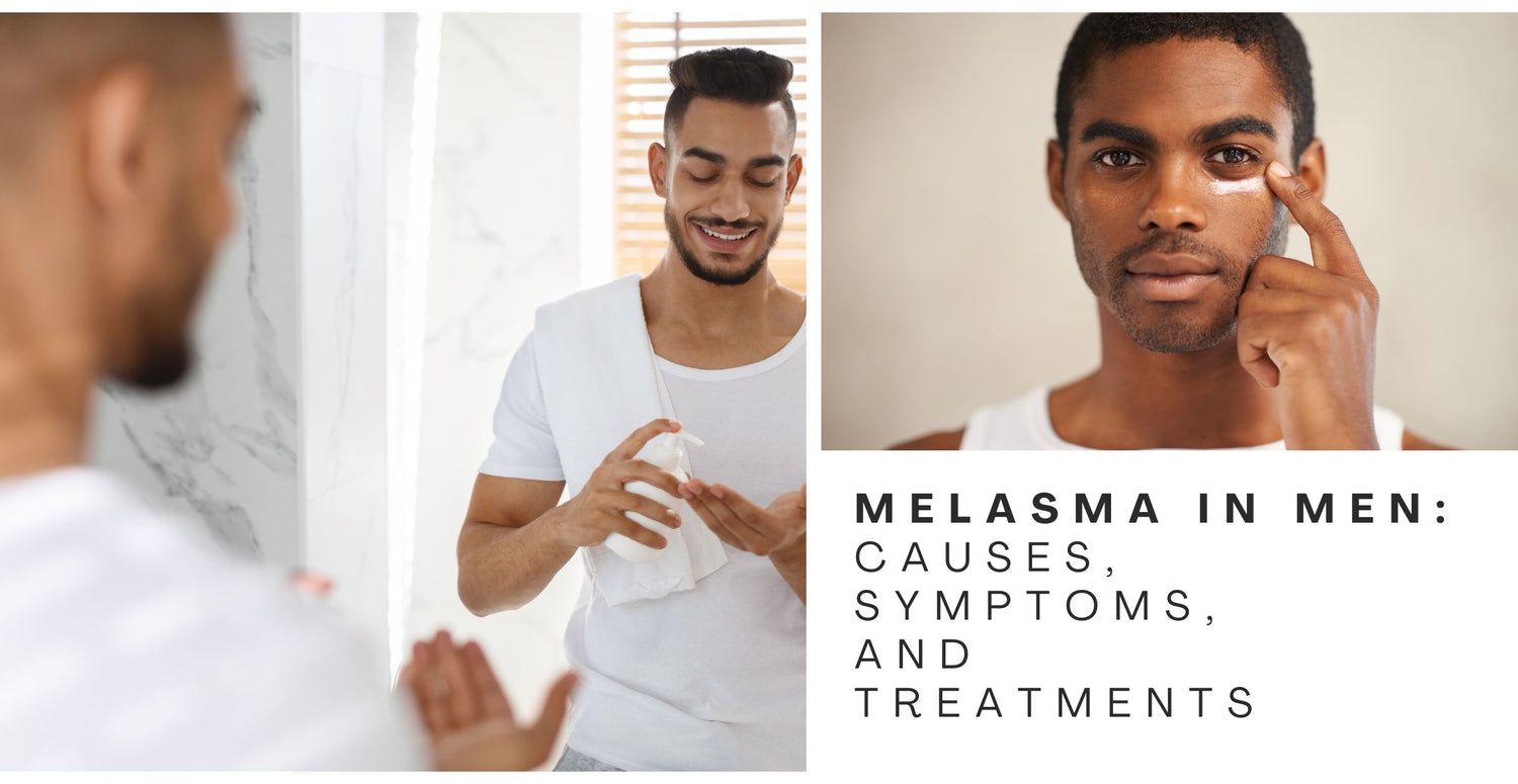 Melasma in Men: Causes, Symptoms, and Treatments