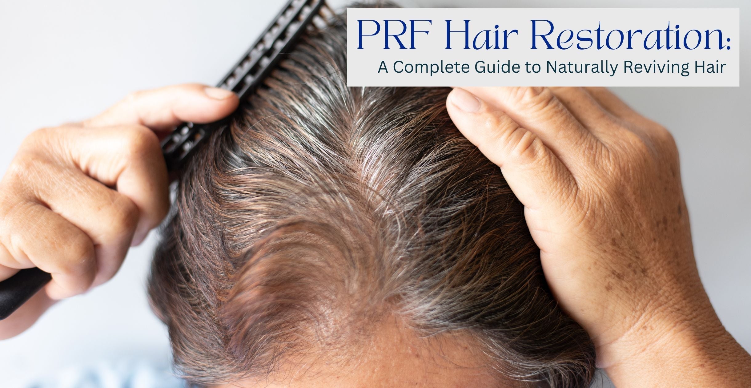 PRF Hair Restoration: A Complete Guide to Naturally Reviving Hair