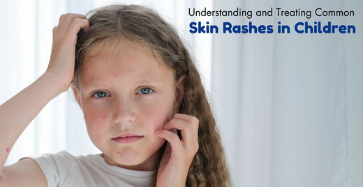 Understanding and Treating Common Skin Rashes in Children