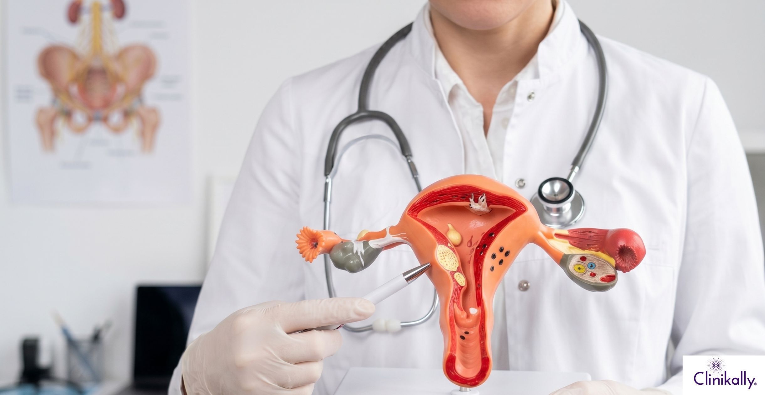 PMOS reproductive health consultation with gynecologist