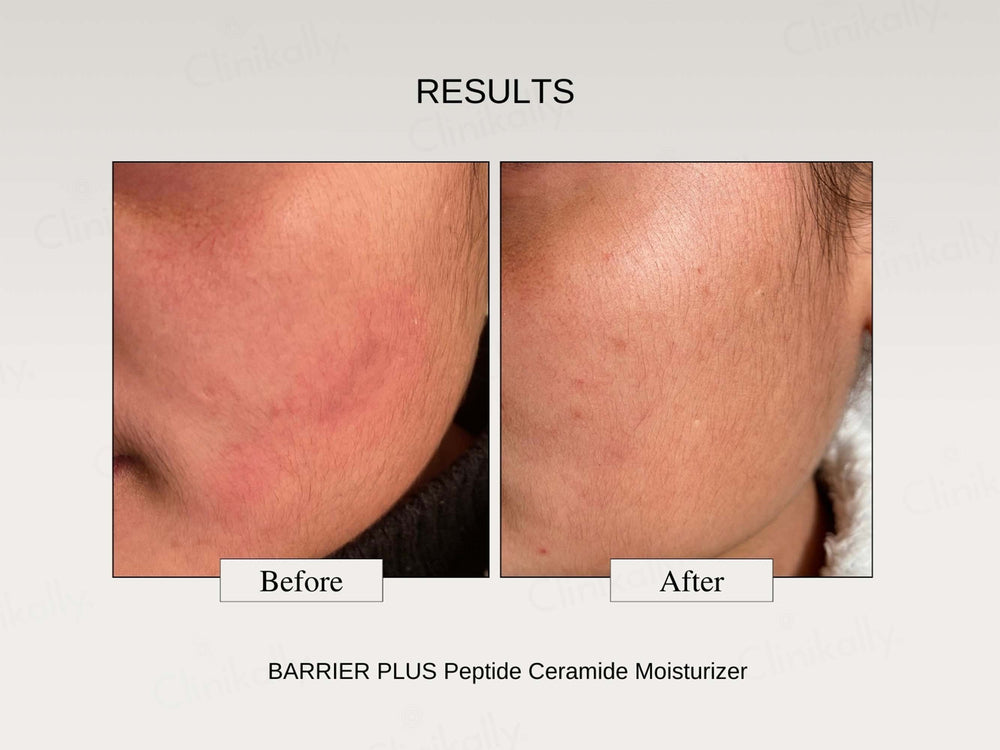 The FormulaRx Barrier Plus Peptide Ceramide Moisturizer