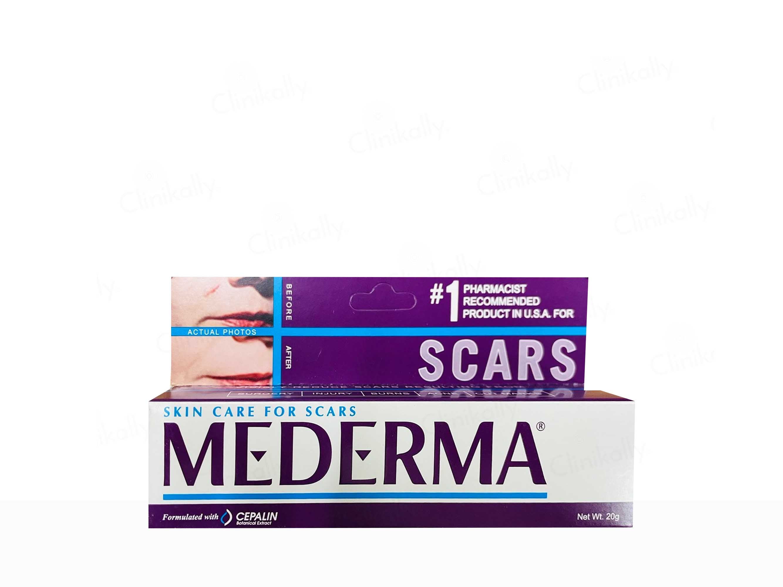 Mederma Skincare Scar Gel