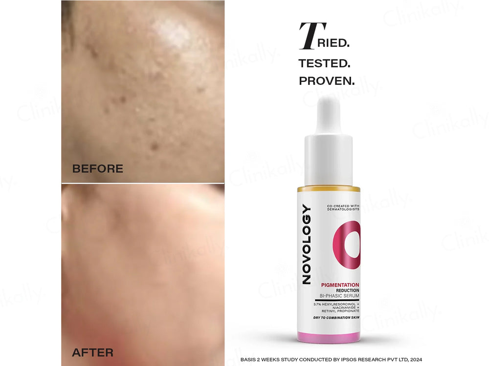 Novology Pigmentation Reduction Bi-Phasic Serum For Dry To Combination Skin