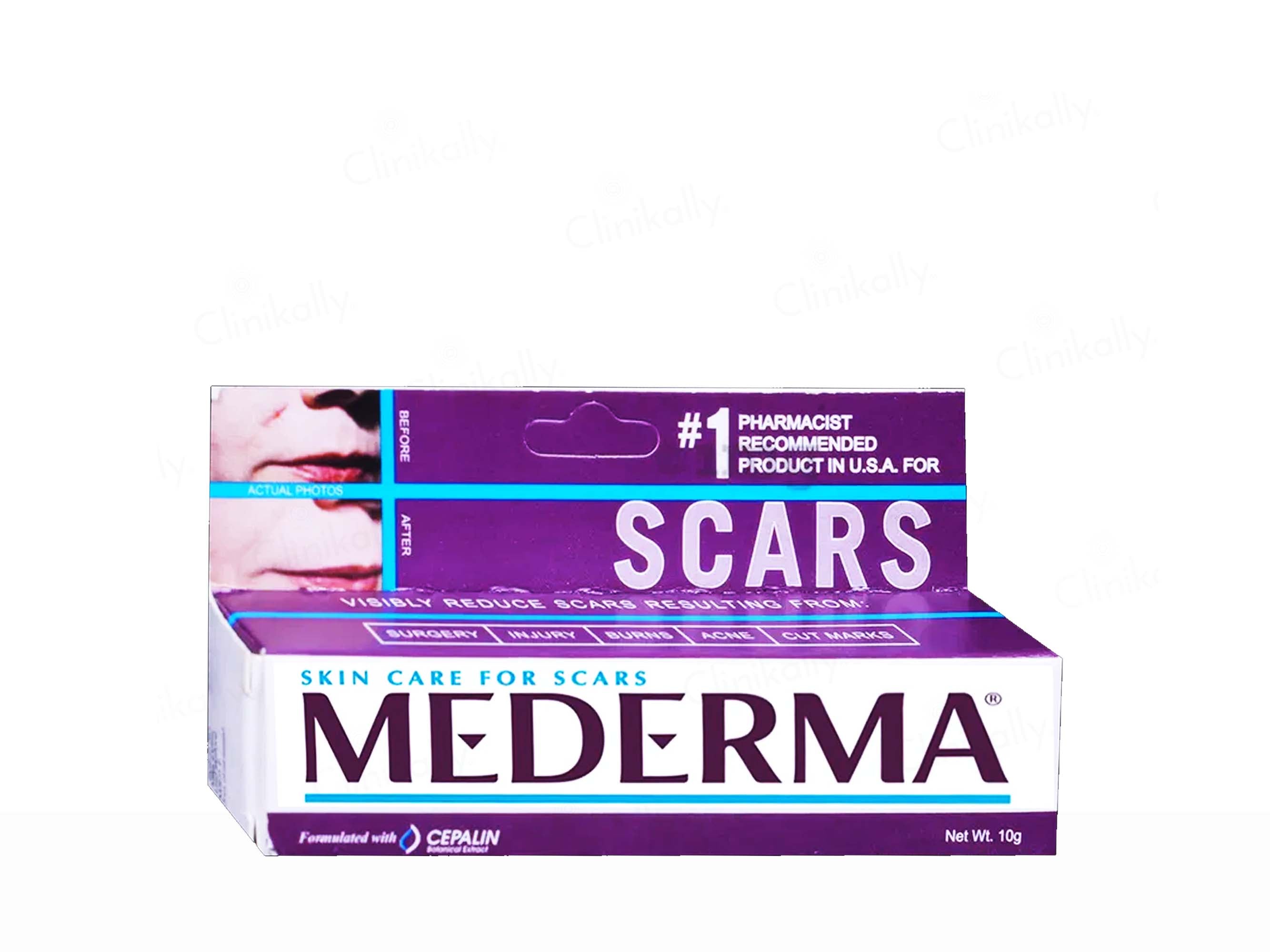 Mederma Skincare Scar Gel